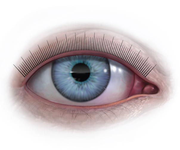 Illustration for vision metering system